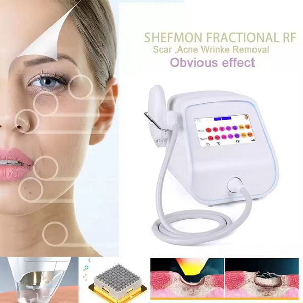 Portátil One alça Tixel Skin Skin Rejuvenenation Beauty Machine Remoção