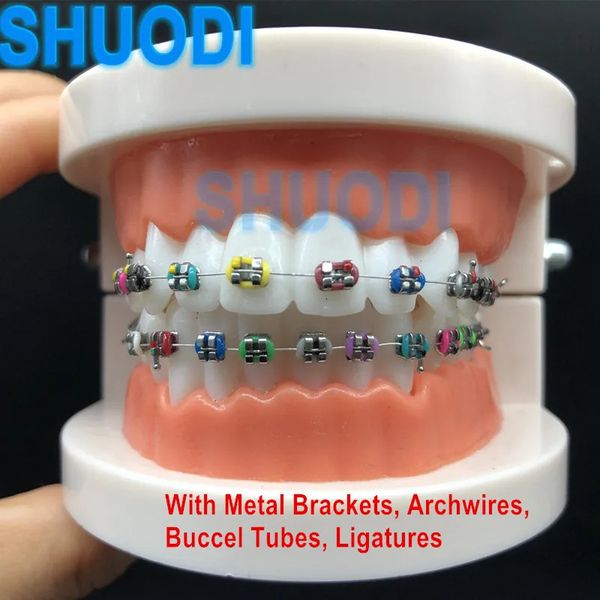 1 pieces Teeth Dental Orthodontic with Brackets Accessories for Patient Communication Dentist Study Model 240705