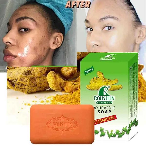 Handmade Soap 2pcs turmeric soap for facial cleansing acne prevention whitening skin whitening facial sebum removal black spots whitening ha