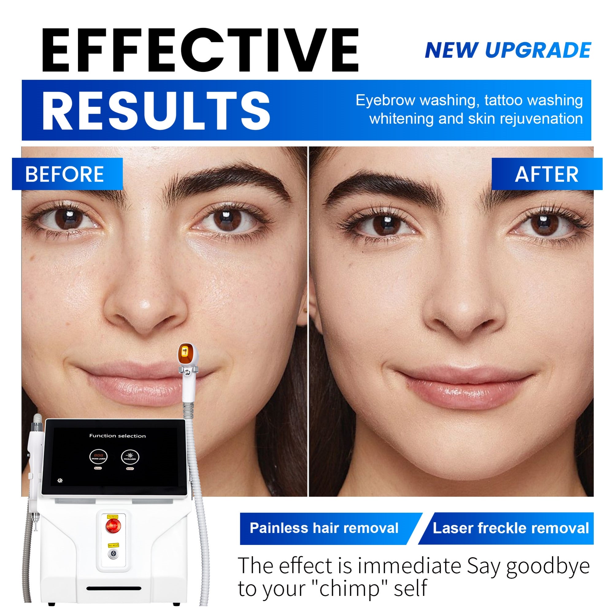 Professional Grade Diode Laser 808nm 2 in 1 Hair Removal and Tattoo Removal for Whole Body Safe and Painless High Power