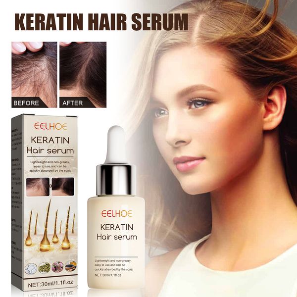 EELHOE Hair Enhancement Essence Moisturizes Hair Repair Roots Thickening Hairline Strengthening Hair Treatment Essence