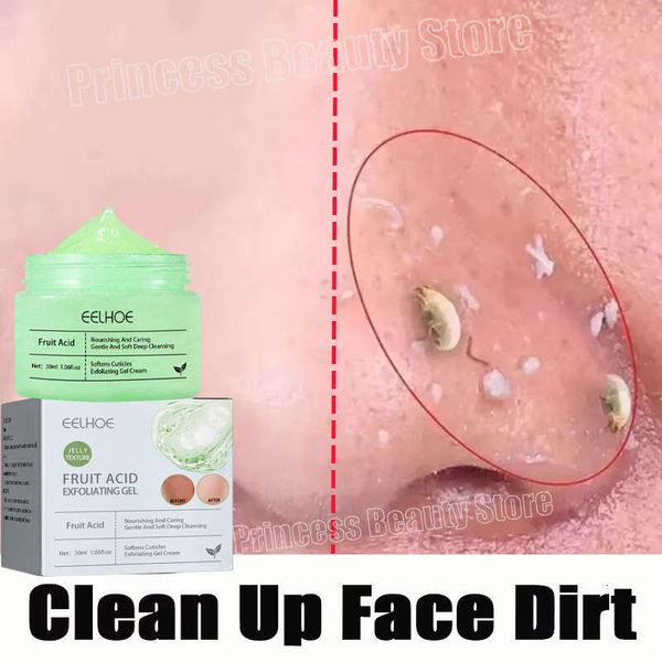 Exfoliating Gel Skin Care Whitening Moisturizer Repair Facial Scrub Cleanser Acne Blackhead Treatment Remove Face Cream