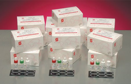 RaPET RF Rheumatoid Factor Latex Agglutination Autoimmune Test Kit