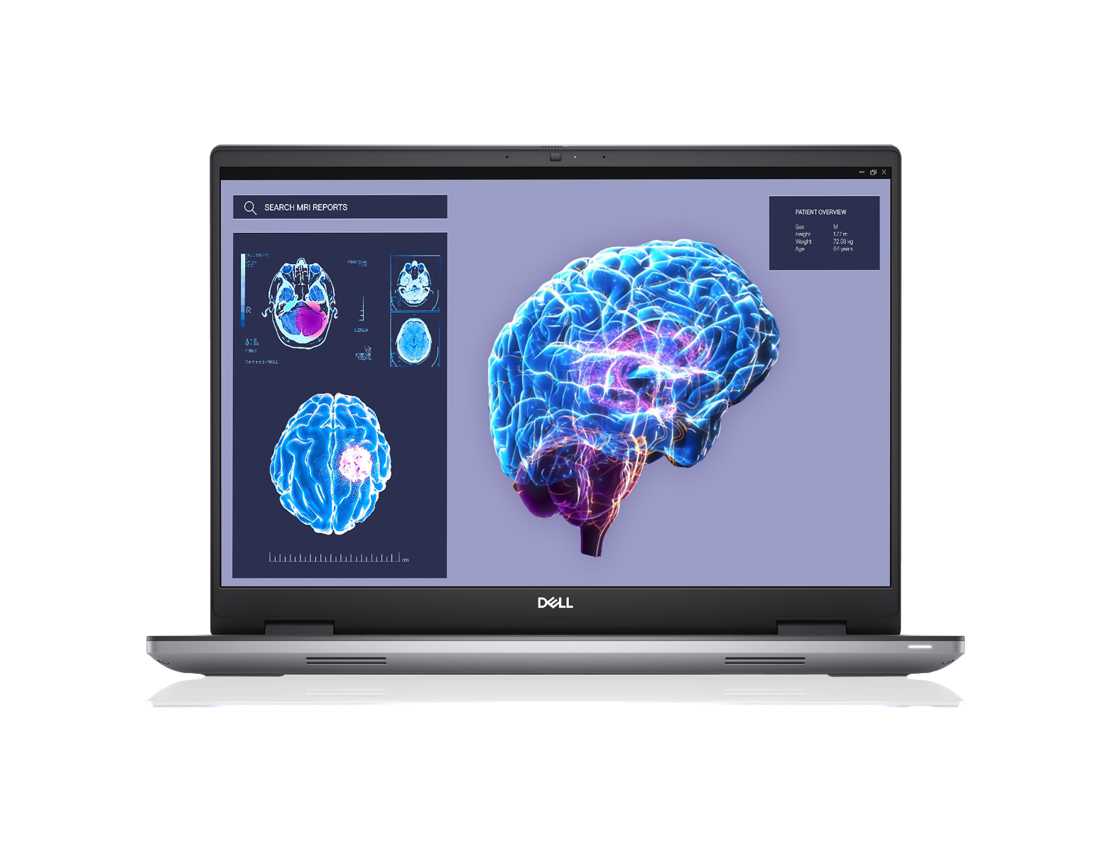 Dell Precision 7680 Workstation laptop - 16" - i7 13850HX - 64GB RAM - 1TB SSD - UK