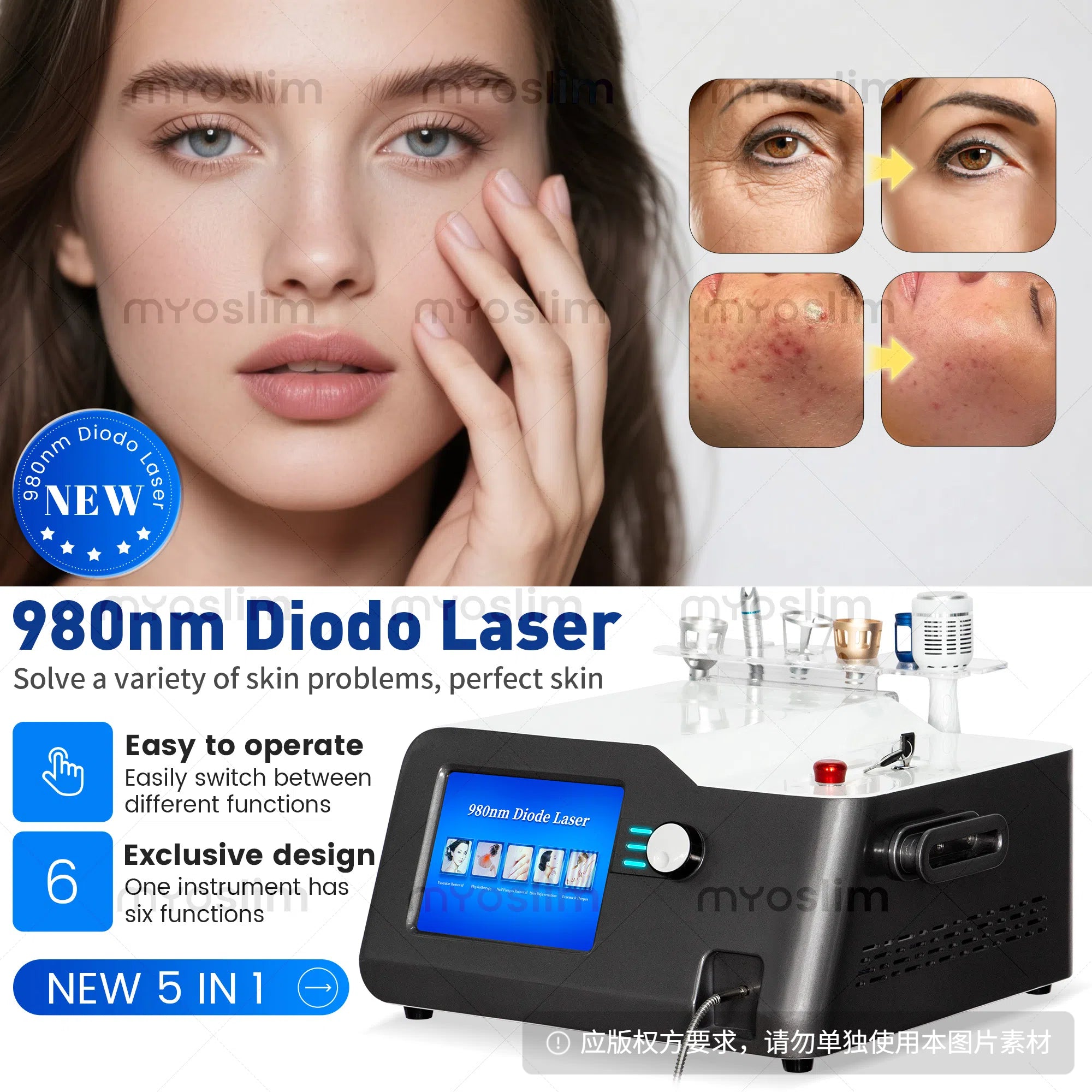 980nm Diode Laser Spider Vein Removal Machine For Spider Veins & Nail Fungus Treatment Home Beauty Care Equipment
