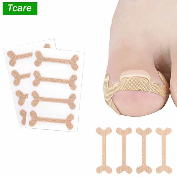Tcare 1 set of toe nail groove foot nail orthodontic equipment thumb nail patch fast foot nail deformation recovery foot care 241203