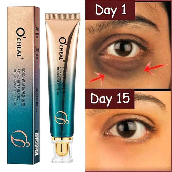 Anti Wrinkle Retinol Fade Fine es Anti-dark Circles Remove Bags Anti-aging Firming Serum Eye Care Cream