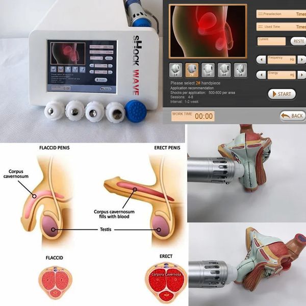 Low Intensity Shock Wave Therapy Machine Portable ESWT Physiotherapy For Erectile Dysfunction and Extracorporeal Pain Treatment Health Care