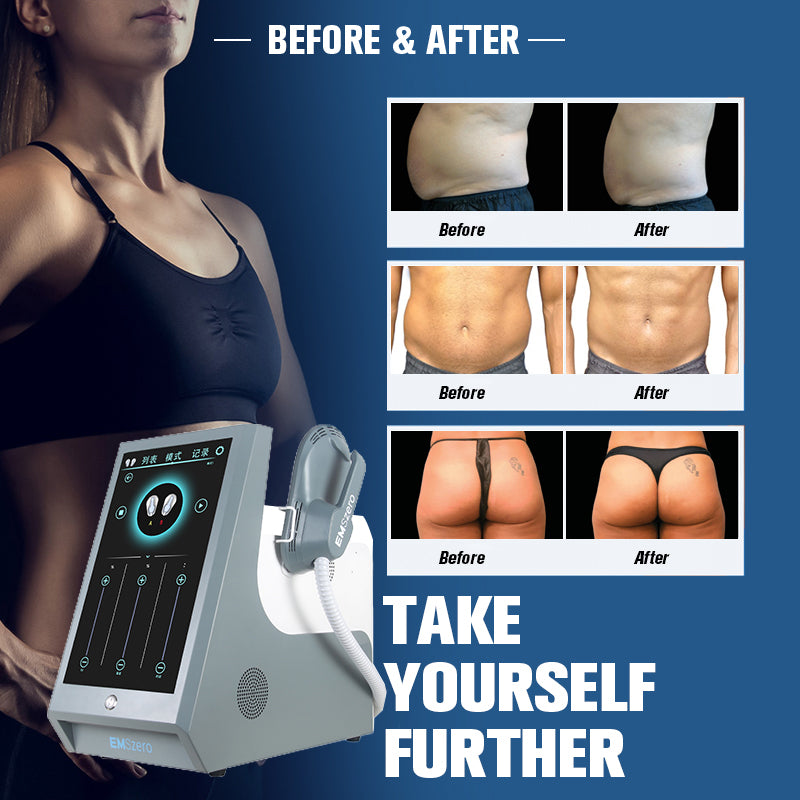 beauty outlet emslim neo hiemt body Sculpting RF 14 Tesla Emzero body shaping Electromagnetic muscle stimulator Ems Slim machine