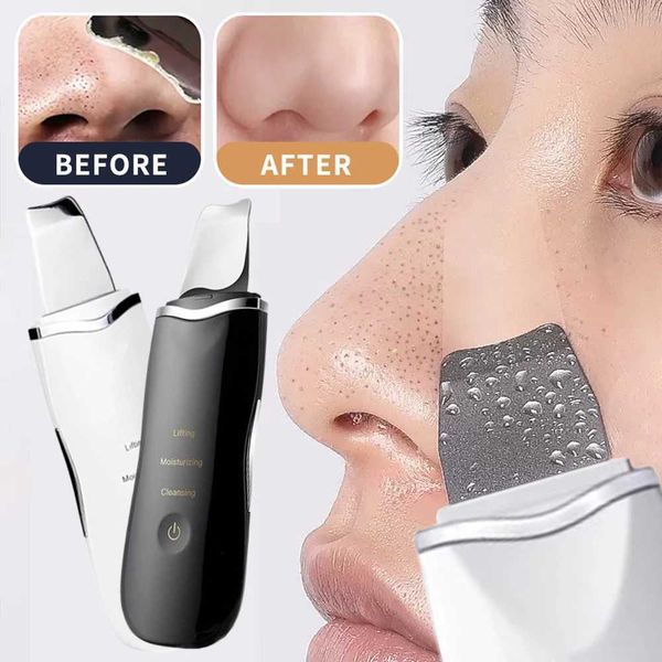 Electric Face Scrubbers skin washer for removing blackheads dark colors facial cleansing ion acne hole cleaning spatula shovel machine H2502