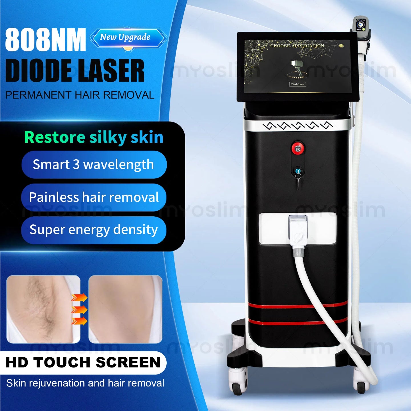 Latest Diode ND:YAG Laser Hair Removal Device - Triple Wavelength, 3000W Power, Painless and Permanent 808nm+1064nm+755nm