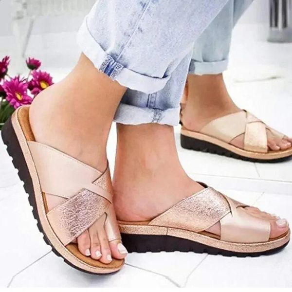 Women Shoes Slippers Orthopedic Bunion Corrector Comfy Platform Ladies Casual Big Toe Correction Sandal Sandalias De Mujer 250115