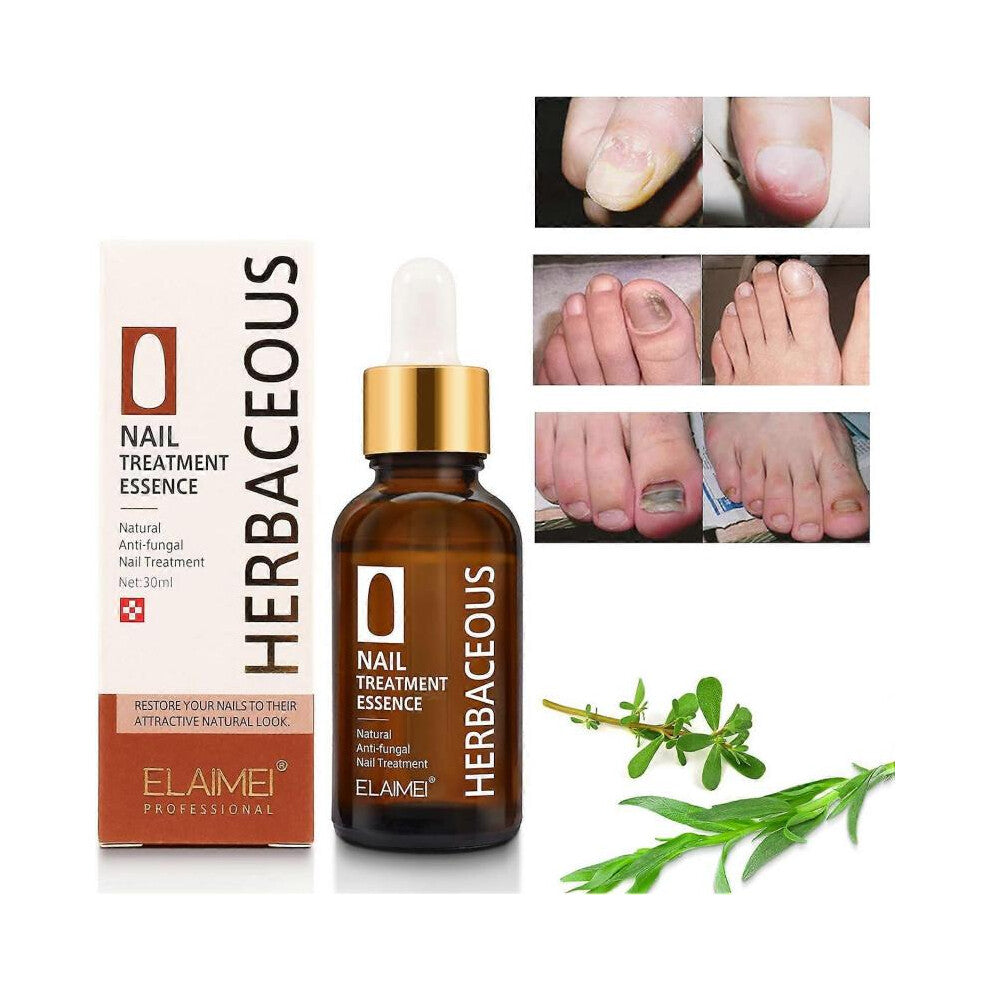 Nail Repair Serum, Anti Fungus Treatment Nail Strengthener Serum, Fungus Nails Renewal Solution for Damaged & Discoloration Nail