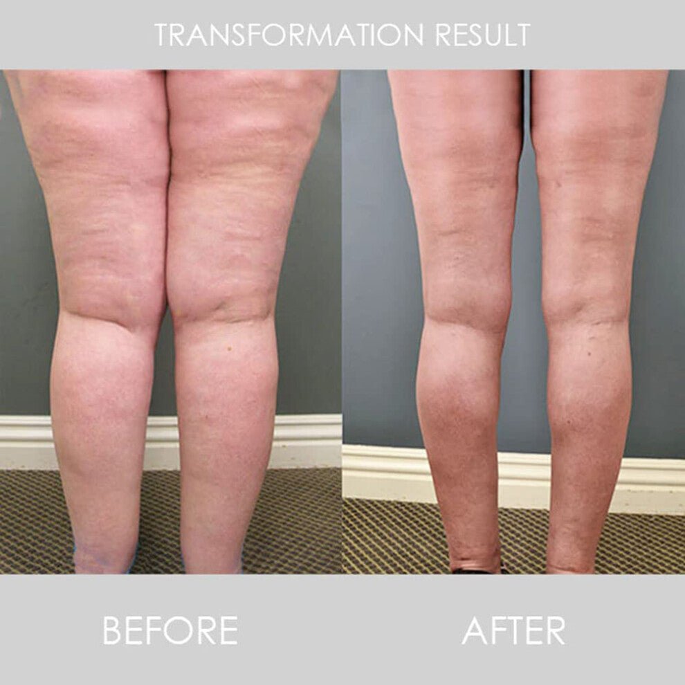 Lymphatic Drainage Copper Cuff for Weight Loss and Muscle Relaxation