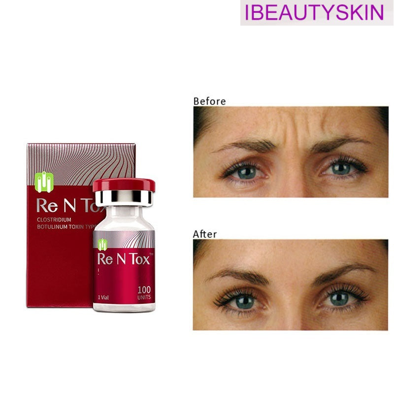 beauty items Saline Innotox Botulax 100u 150u 200u 50iu BTX toxins Nabota Hutoxs ReNtox Meditoxins botulinicas