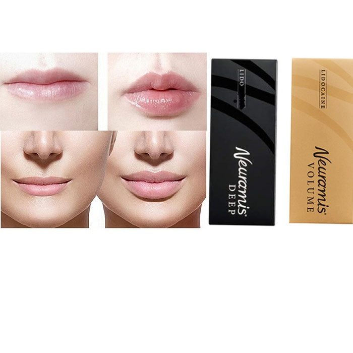 Beauty Items Neuramis Volume Deep SARDENYA Dermal Filler 1ML