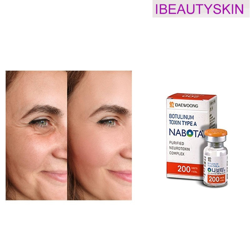 beauty items Other Body Sculpting & Slimming 100 200 Units Hutoxs Nabotas Innotox Botulaxs Botuliz Rentox