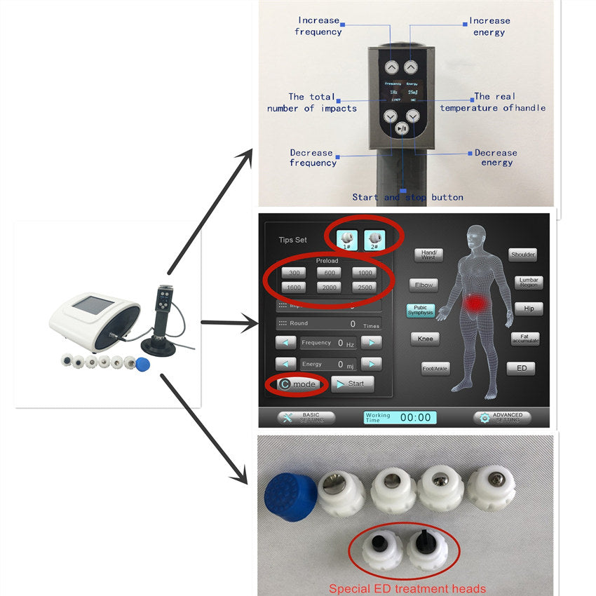 Orthopedics Therapy Equipment SWT Erectile Dysfunction Shock Wave Therapy (EDSWT) With 7 Different Size Of Tip