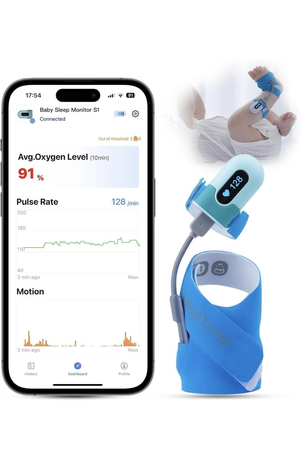 BABYTONE SMART SLEEP WEARABLE SOCK FOOT MONITOR (OXYGEN/PULSE/MOVEMENT) 0-36 MOS